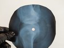 JONY MITCHEL TIN ANGEL X-Ray USSR Record Roentgen Bones Ribs Music Vinyl