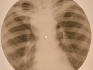 X-RAY USSR  ROENTGEN BONES RECORD ORIGINAL OLD RIBS 548