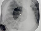 X-RAY ROENTGEN USSR  BONES RECORD ORIGINAL OLD RIBS 558