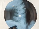 BOB DYLAN MY BACK PAGES X-Ray USSR Record Roentgen Bone Ribs Music Vinyl