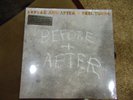 Neil Young - Before And After NEW Vinyl