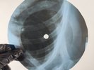 DOORS MOONLIGHT DRIVE X-Ray USSR Record Roentgen Bones Ribs Music Vinyl