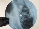 PETER SARSTEDT WHERE DO YOU GO X-Ray USSR Record Roentgen Bone Ribs Music Vinyl