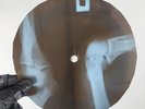 PINK FLOYD APPLES&ORANGES X-Ray USSR Record Roentgen Bone Ribs Music Vinyl