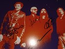 Zoe Signed Vinyl Sonidos De Karmatica Resonancia,Caifanes, Cafe Tacuba