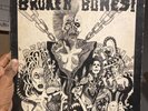 Broken Bones  