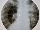 USSR X-RAY ROENTGEN BONES RECORD ORIGINAL OLD RIBS 565