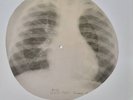 X-RAY USSR  ROENTGEN BONES RECORD ORIGINAL OLD RIBS 568