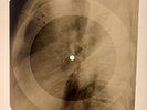 USSR X-RAY ROENTGEN BONES RECORD ORIGINAL OLD RIBS 536