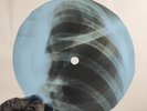 LITTLE RICHARD READY TEDDY X-Ray USSR Record Roentgen Bones Ribs Music Vinyl