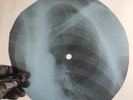NICO CHELSEA GIRL X-Ray USSR Record Roentgen Bones Ribs Music Vinyl