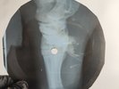 DAVID BOWIE LETTER TO HERMIONE X-Ray USSR Record Roentgen Bones Ribs Music Vinyl