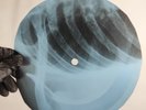 BOB DYLAN PLEDGING MY TIME X-Ray USSR Record Roentgen Bones Ribs Music Vinyl