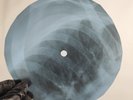 BOB DYLAN DOMT THINK TWICE X-Ray USSR Record Roentgen Bones Ribs Music Vinyl