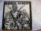 Broken Bones : Dem Bones  Vinyl LP - 1984 FALL LP 028  VG  Punk 'Oi'  RARE PRESS