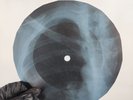 BOB DYLAN NORTH COUNTRY BLUES X-Ray USSR Record Roentgen Bones Ribs Music Vinyl