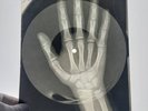 X-RAY HAND USSR  ROENTGEN BONES RECORD ORIGINAL OLD RIBS 561