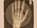 X-RAY HAND USSR  ROENTGEN BONES RECORD ORIGINAL OLD RIBS 544
