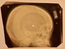 USSR X-RAY SKULL ROENTGEN BONES RECORD ORIGINAL OLD RIBS 481