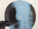 ROLLING STONES BACKSTREET GIRL X-Ray USSR Record Roentgen Bones Ribs Music Vinyl
