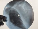 PINK FLOYD IF X-Ray USSR Record Roentgen Bones Ribs Music Vinyl