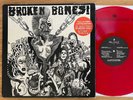 BROKEN BONES 