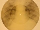 X-RAY USSR ROENTGEN BONES RECORD ORIGINAL OLD RIBS 583