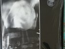Fudge Tunnel – Hate Songs In E Minor (UK 91,Earache – MOSH 36) Lp, Insert, 7
