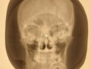SALE  X-RAY SKULL USSR ROENTGEN BONES RECORD ORIGINAL OLD RIBS 593