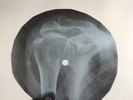BLACK SABBATH SLEPPING VILLAGE X-Ray USSR Record Roentgen Bone Ribs Music Vinyl