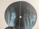 BEATLES LET IT BE  X-Ray USSR Record Roentgen Bone Ribs Music Vinyl