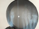 BEATLES LET IT BE  X-Ray USSR Record Roentgen Bone Ribs Music Vinyl