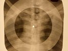 X-RAY USSR ROENTGEN BONES RECORD ORIGINAL OLD RIBS 636