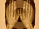 X-RAY USSR  ROENTGEN BONES RECORD ORIGINAL OLD RIBS 641
