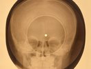 SALE  USSR X-RAY SKULL ROENTGEN BONES RECORD ORIGINAL OLD RIBS 665.1