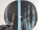 BEATLES I WANT YO HOLD YOUR X-Ray USSR Record Roentgen Bone Ribs Music Vinyl