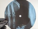 BEATLES ALL YOU NEED IS LOVE X-Ray USSR Record Roentgen Bone Ribs Music Vinyl