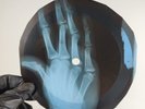 BEATLES AND I LOVE HER X-Ray USSR Record Roentgen Bone Ribs Music Vinyl