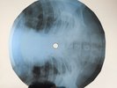 DAVID BOWIE SUPERMAN X-Ray USSR Record Roentgen Bone Ribs Music Vinyl