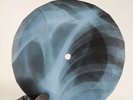 PINK FLOYD APPLES&ORANGES X-Ray USSR Record Roentgen Bone Ribs Music Vinyl