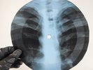 ELVIS ITS NOW OR NEVER X-Ray USSR Record Roentgen Bone Ribs Music Vinyl