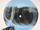DOORS SUMMER ALMOST GONE X-Ray USSR Record Roentgen Bone Ribs Music Vinyl