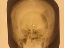 X-RAY SKULL USSR ROENTGEN BONES RECORD ORIGINAL OLD RIBS 629