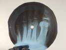 ELVIS GIRL OF MY BEST FRIEND X-Ray USSR Record Roentgen Bone Ribs Music Vinyl