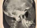 USSR X-RAY SKULL ROENTGEN BONES RECORD ORIGINAL OLD RIBS 535