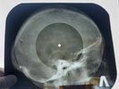 USSR X-RAY SKULL ROENTGEN BONES RECORD ORIGINAL OLD RIBS 552
