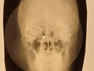 USSR X-RAY SKULL ROENTGEN BONES RECORD ORIGINAL OLD RIBS 612