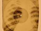 X-RAY USSR ROENTGEN BONES RECORD 78 rpm ORIGINAL OLD RIBS 638