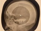 X-RAY SKULL RIBS HAND ROENTGEN USSR BONES RECORD 592 600,20,50,58,67,74,97 8pcs