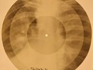X-RAY USSR ROENTGEN BONES RECORD 78 rpm ORIGINAL OLD RIBS 659